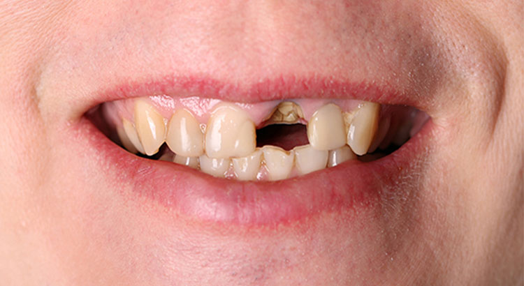 Before image